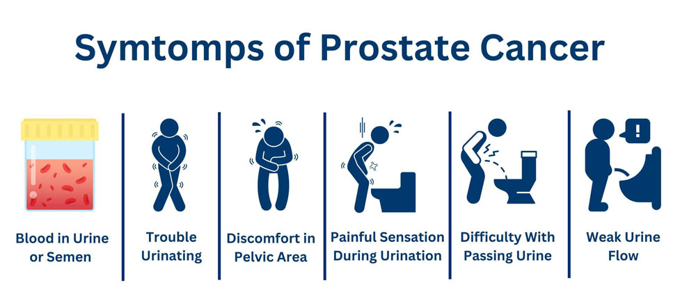 Common prostate cancer symptoms such as difficulty urinating, weak urine flow, and blood in urine or semen.