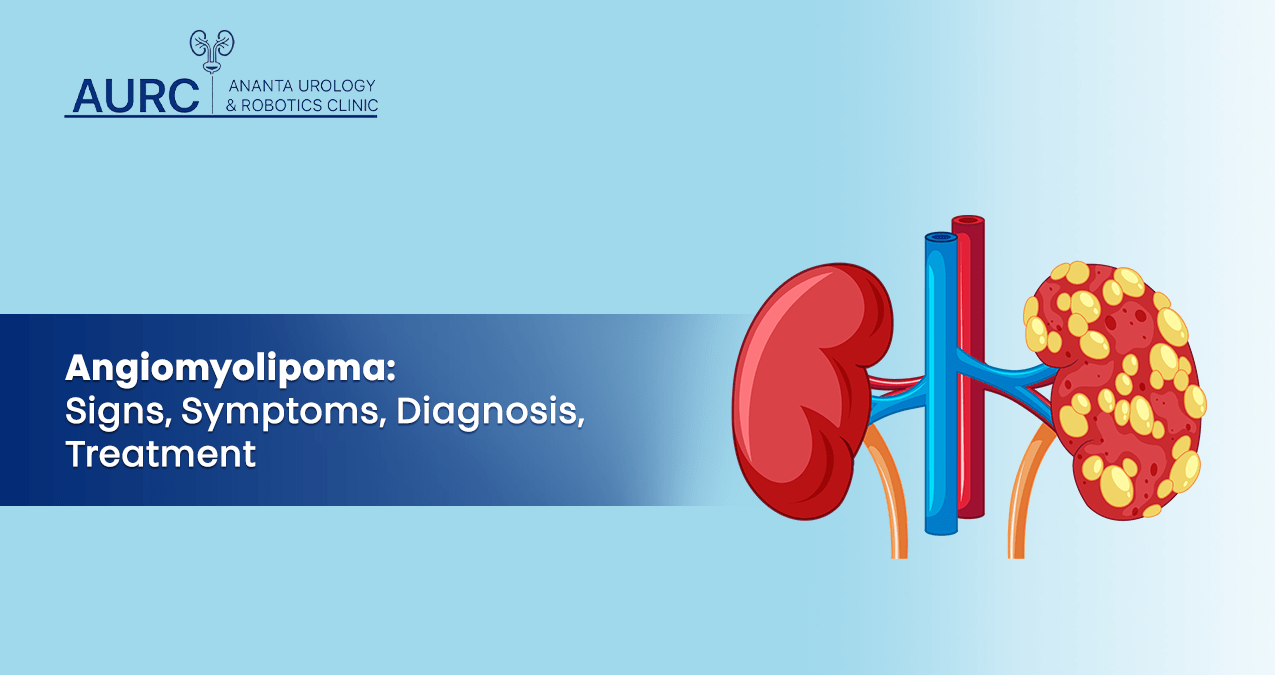 Angiomyolipoma in the kidney with signs, symptoms, and treatment.