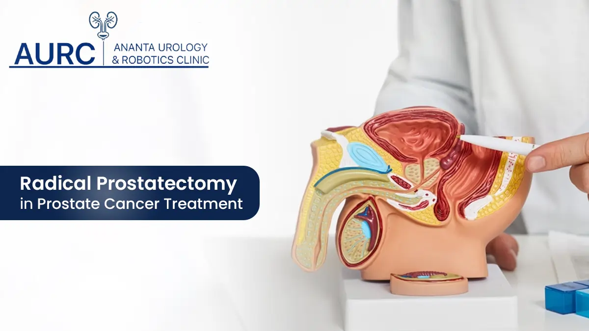 Robotic Prostatectomy : A Definitive Guide in Understanding Prostate Cancer's Gold Standard Treatment