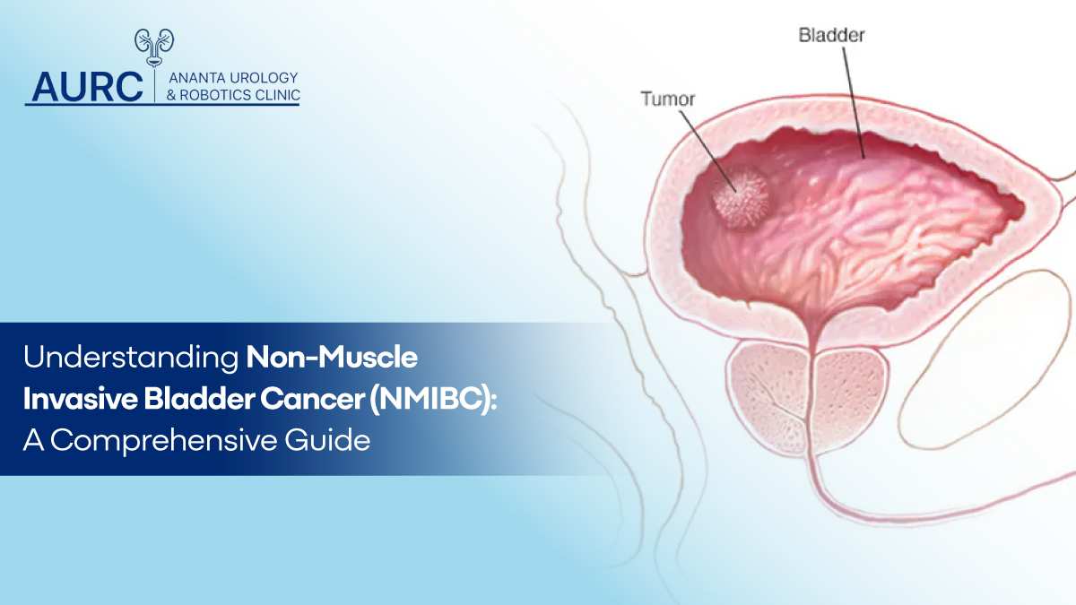 understanding non muscle invasive bladder cancer